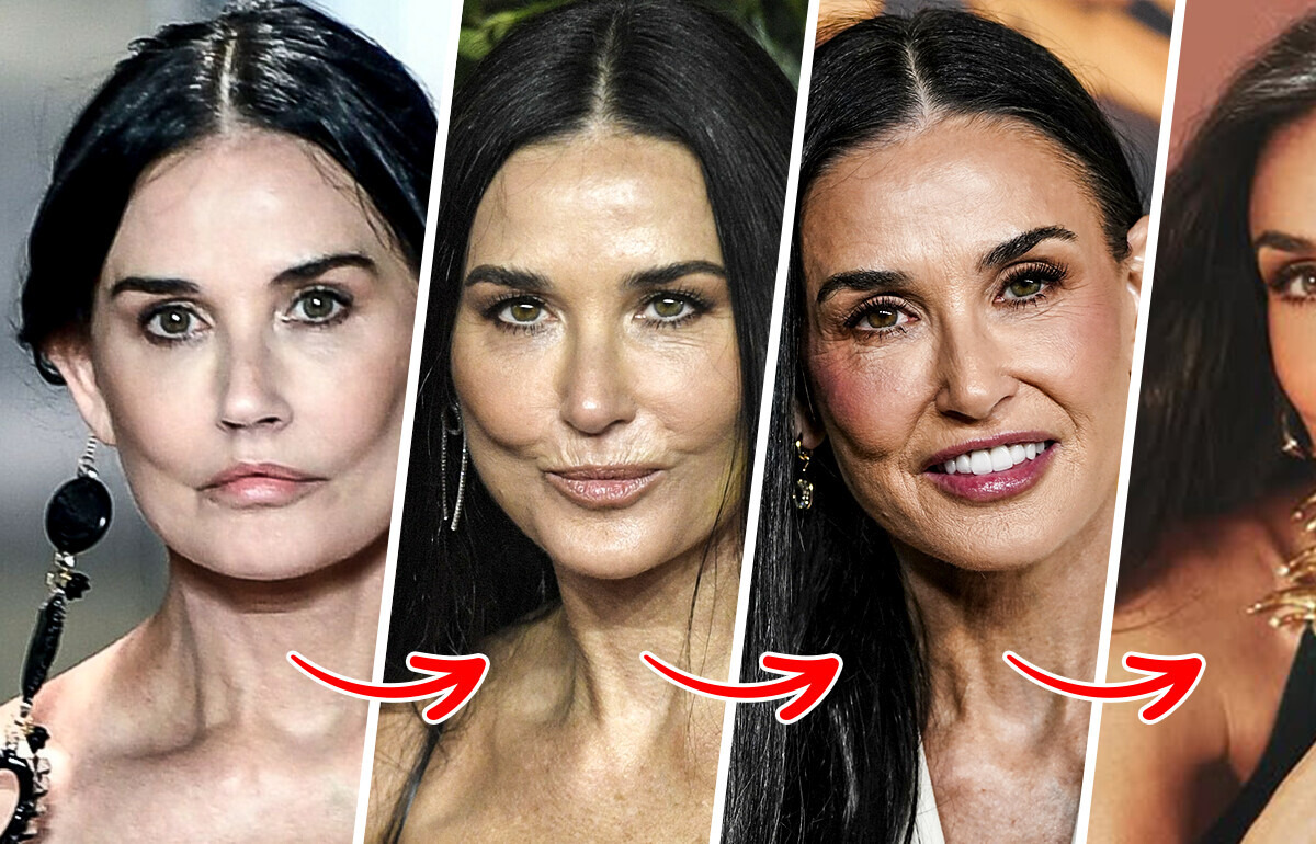 “She’s Clearly Had Some Things Removed,” Surgeon Spills the Secrets Behind Demi Moore’s Timeless Beauty “She’s Clearly Had Some Things Removed,” Surgeon Spills the Secrets Behind Demi Moore’s Timeless Beauty