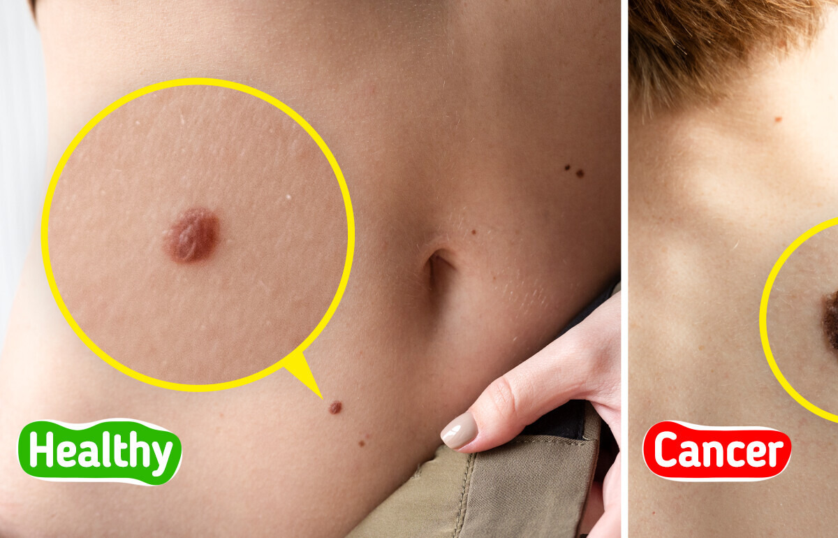 8 Sneaky Signs Your Skin May Be Revealing Serious Health Problems