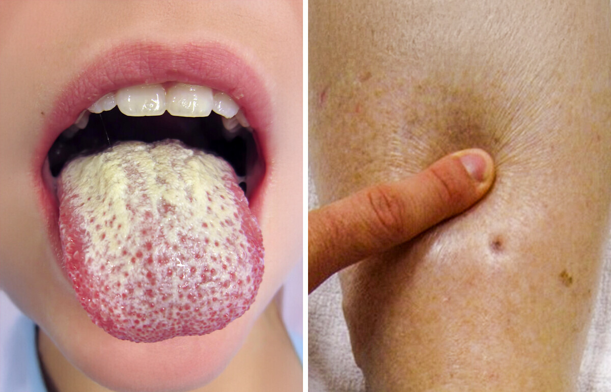 7 Non-Obvious Signs Your Body May Be Using to Scream for Help 7 Non-Obvious Signs Your Body May Be Using to Scream for Help