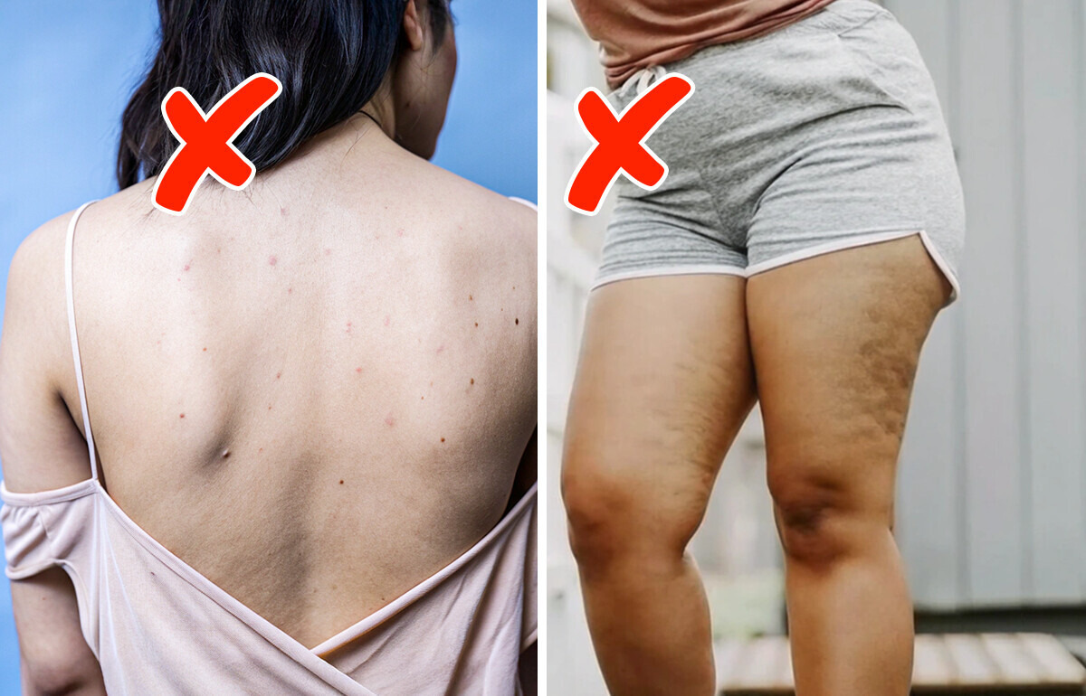 8 Not Obvious Health Effects of Wearing Clothes That Are Too Tight 8 Not Obvious Health Effects of Wearing Clothes That Are Too Tight