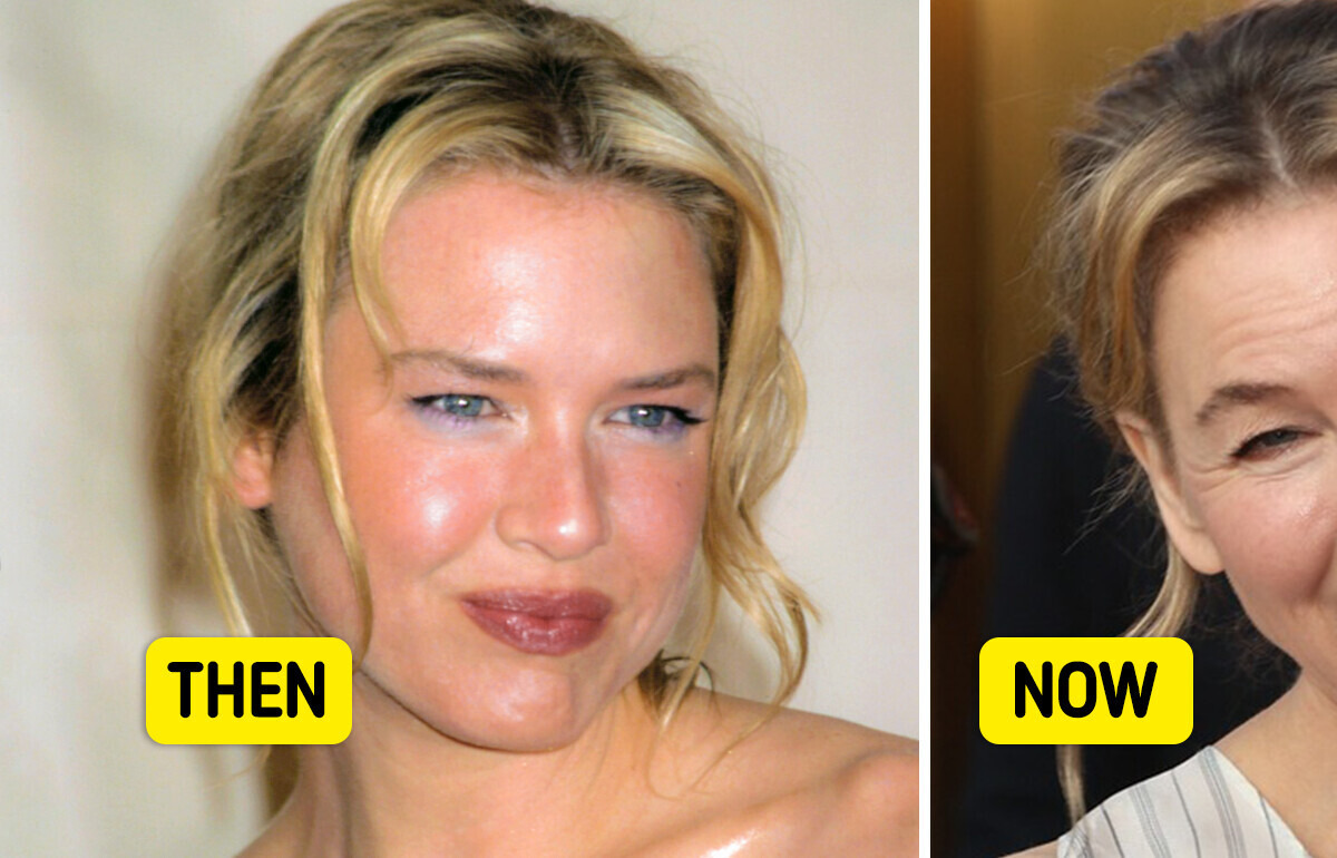 Renée Zellweger’s Lips Look Unusual, and Everyone Wants Answers
