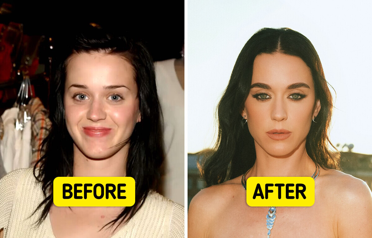 18 Stars Who Openly Talked About Plastic Surgery