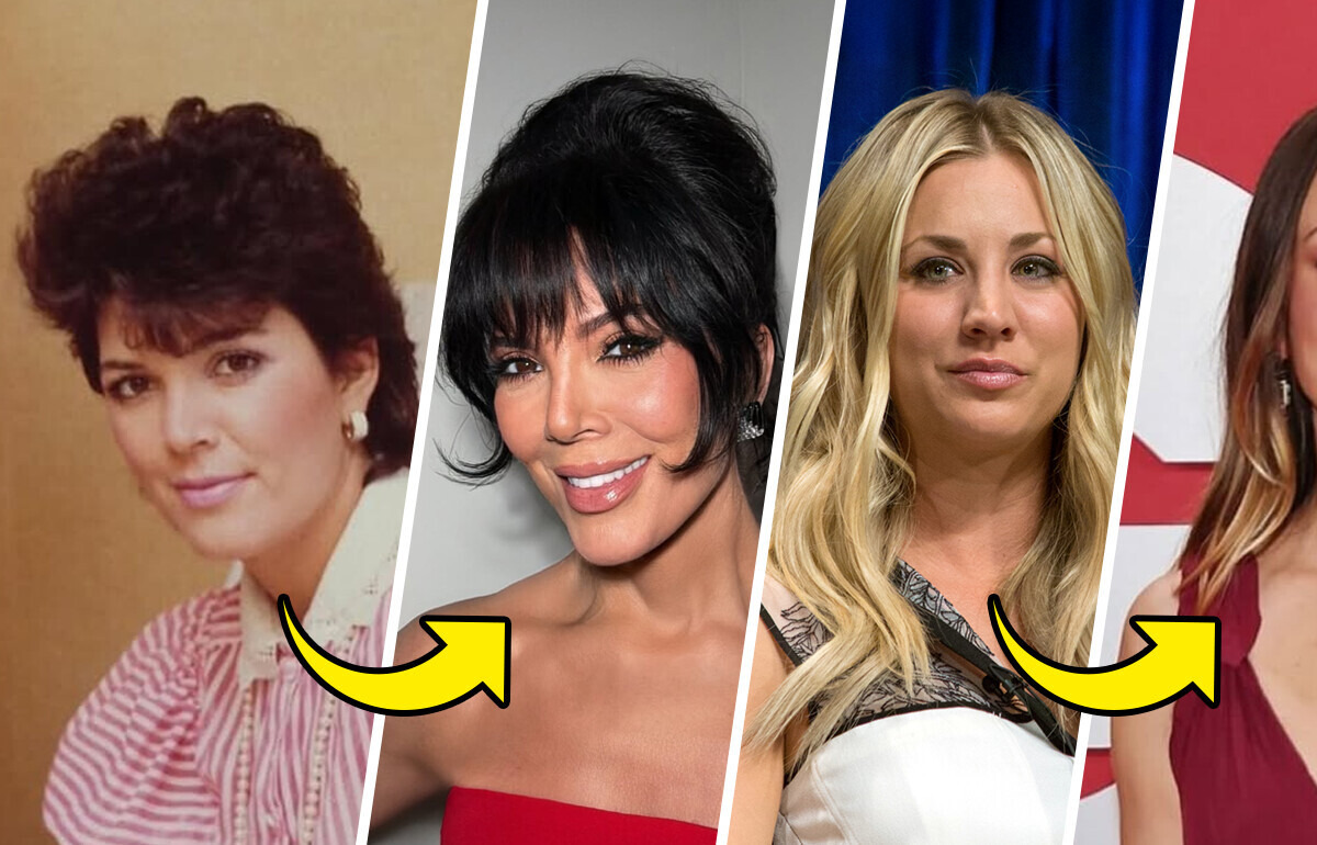 15 Stars Who Openly Embraced Cosmetic Procedures — And Love Their Results