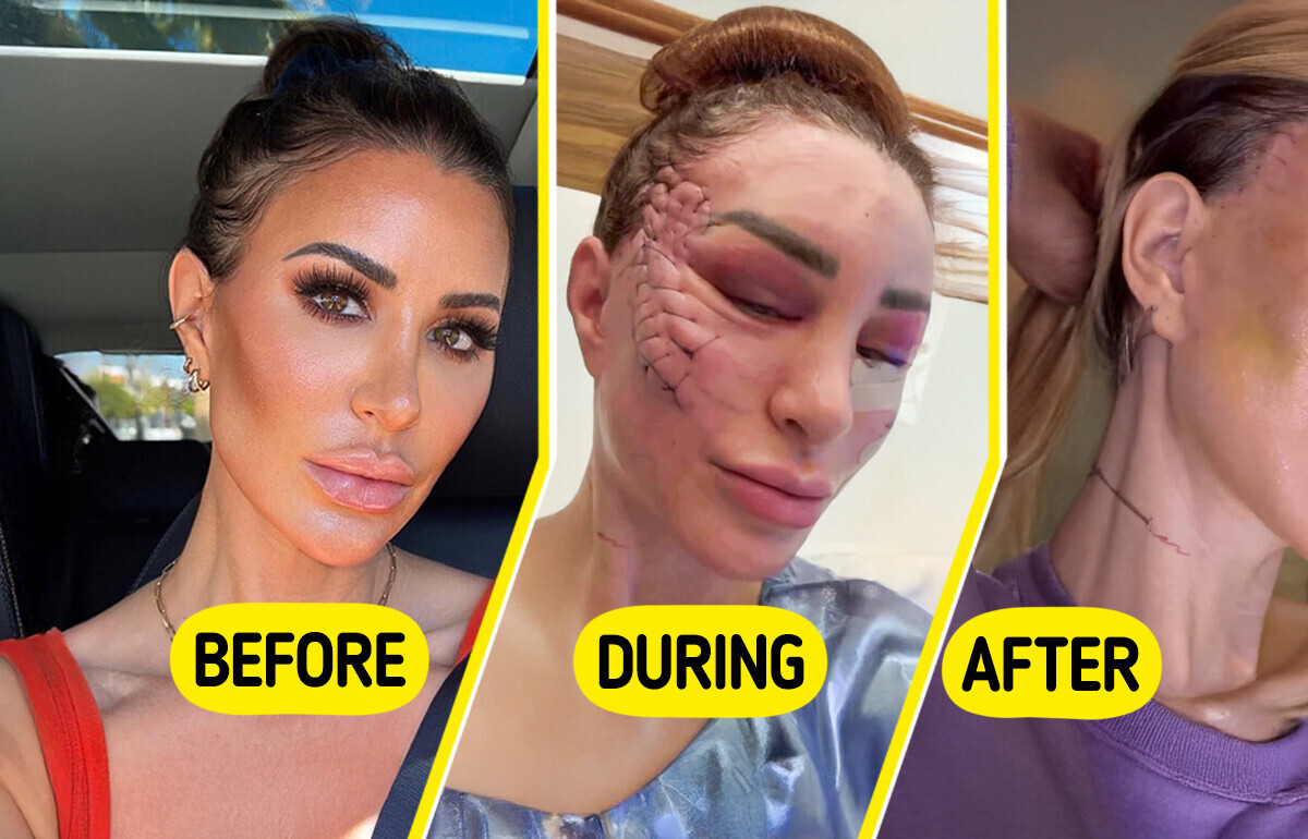 This Woman’s Unique Facelift Leaves Everyone Speechless