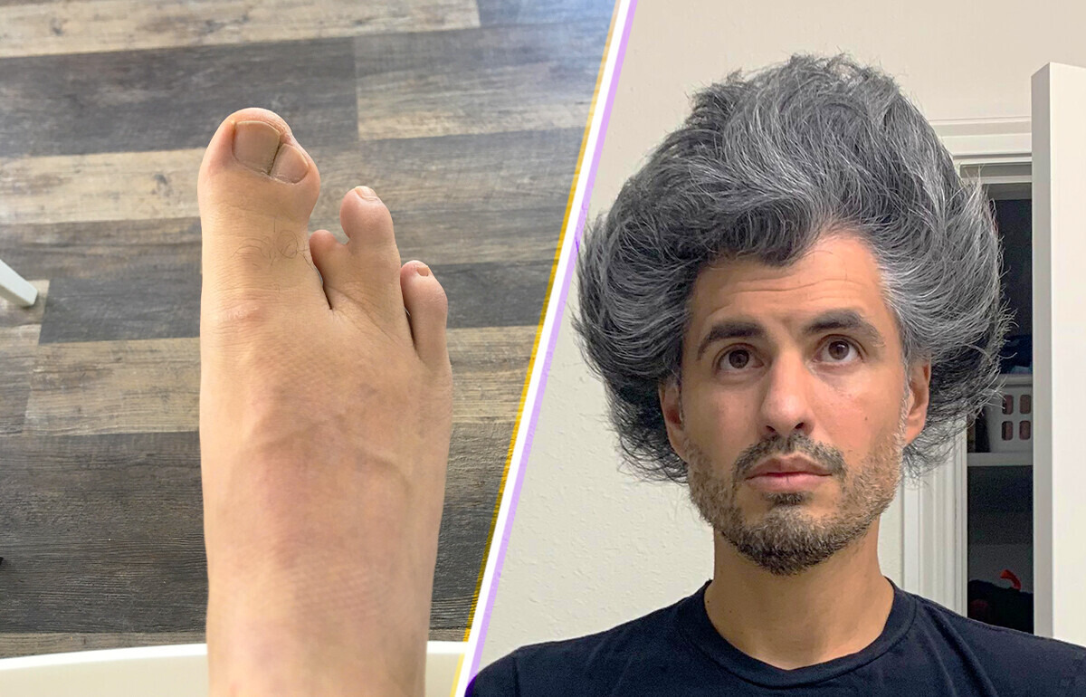 15 People Who Revealed Something Truly Unique About Their Bodies
