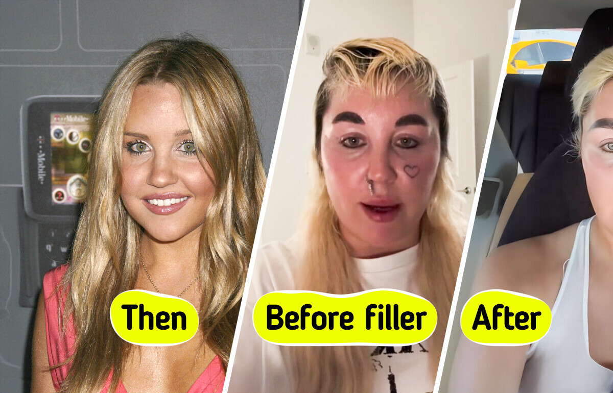 Amanda Bynes, 39, Revealed Her Dramatic New Look, Leaving People in Awe