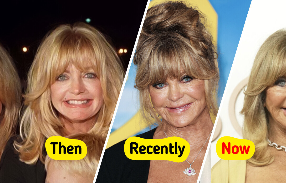 “What Did She Do to Her Mouth?”, Goldie Hawn Alarmed Fans With Her Changed Appearance “What Did She Do to Her Mouth?”, Goldie Hawn Alarmed Fans With Her Changed Appearance