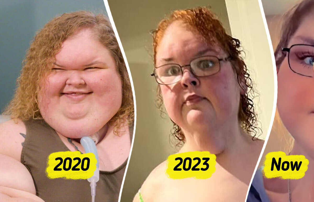 “1000-lb Sisters” Star Reveals Stunning New Look After Skin Removal Surgery, Leaving People in Awe