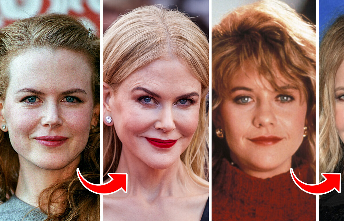 10+ Famous People Whose Appearances Changed Beyond Recognition