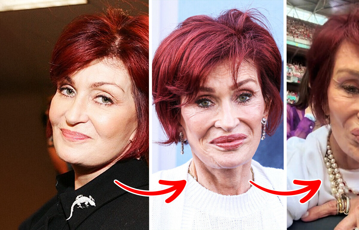 “I Went Too Far,” Sharon Osbourne, 72, Reveals What’s Really Behind Her New Look