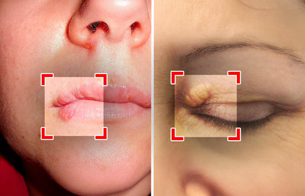 4 Signs on Your Face That Could Quietly Reveal Health Issues