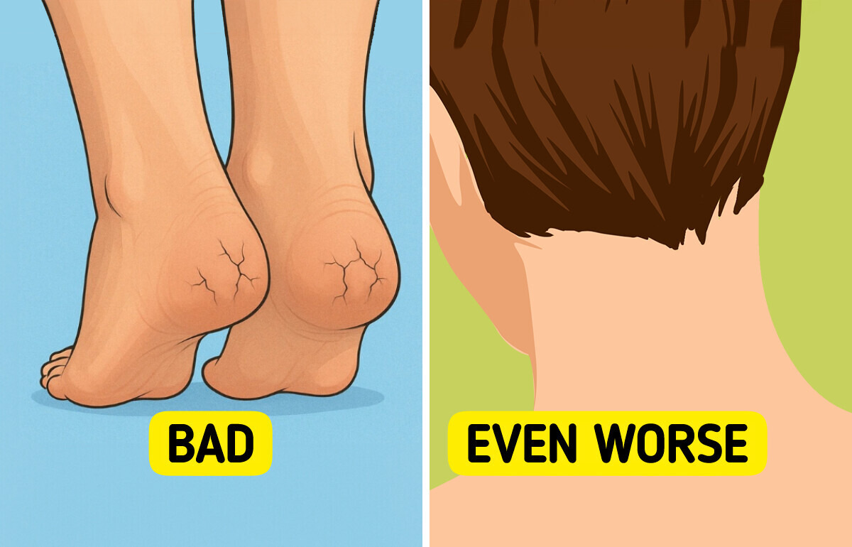 10 Alarming Clues Your Body Might Be Reacting to Blood Sugar Spikes
