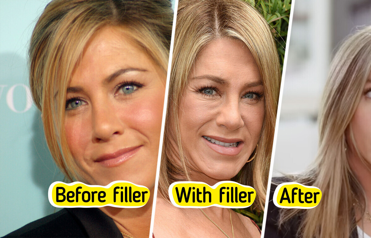 “I’m Not Even Going to Try Anymore,” Jennifer Aniston Revealed Truth About Botox, Fillers, and Ageing