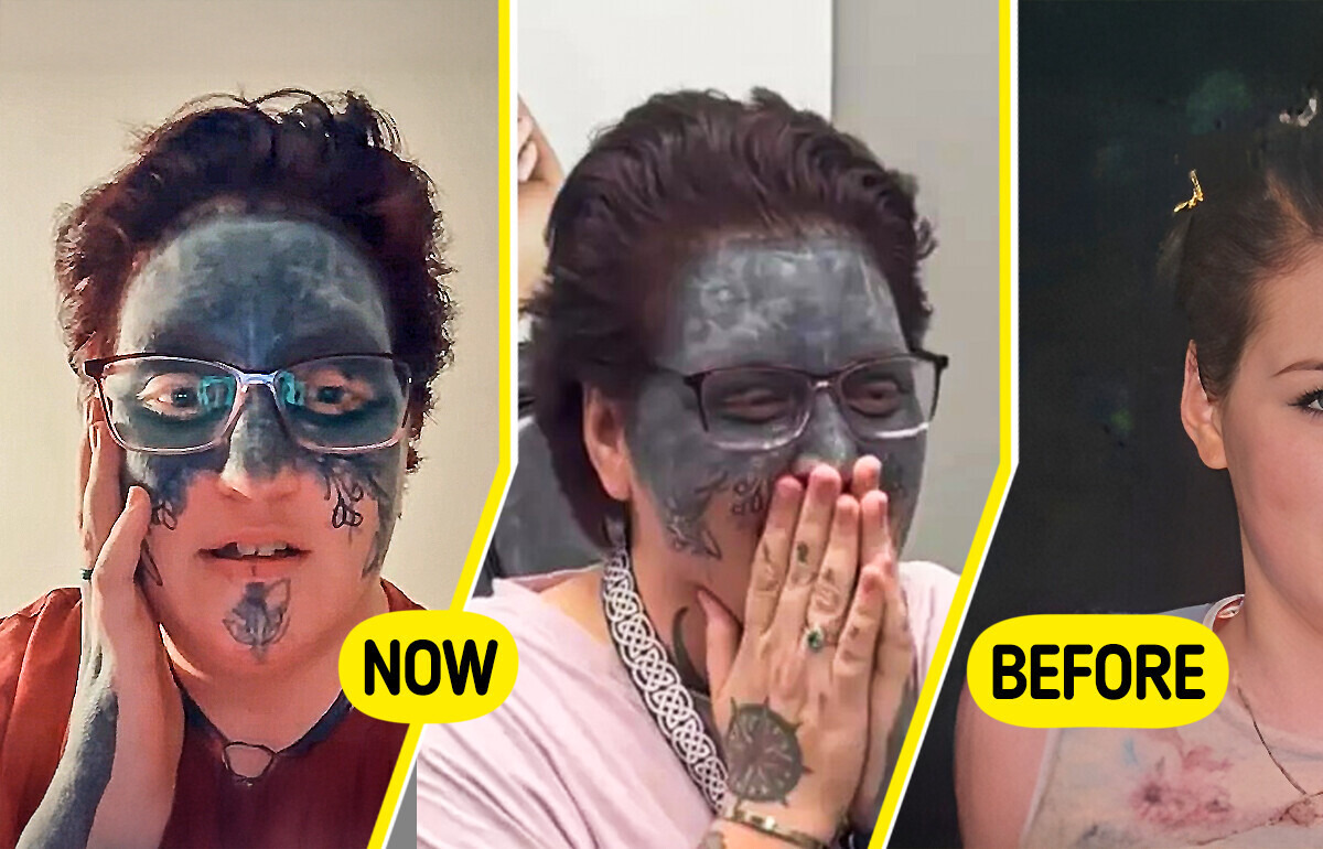 A Woman’s Face Was Marked Against Her Will — But She’s Finally Getting It Removed