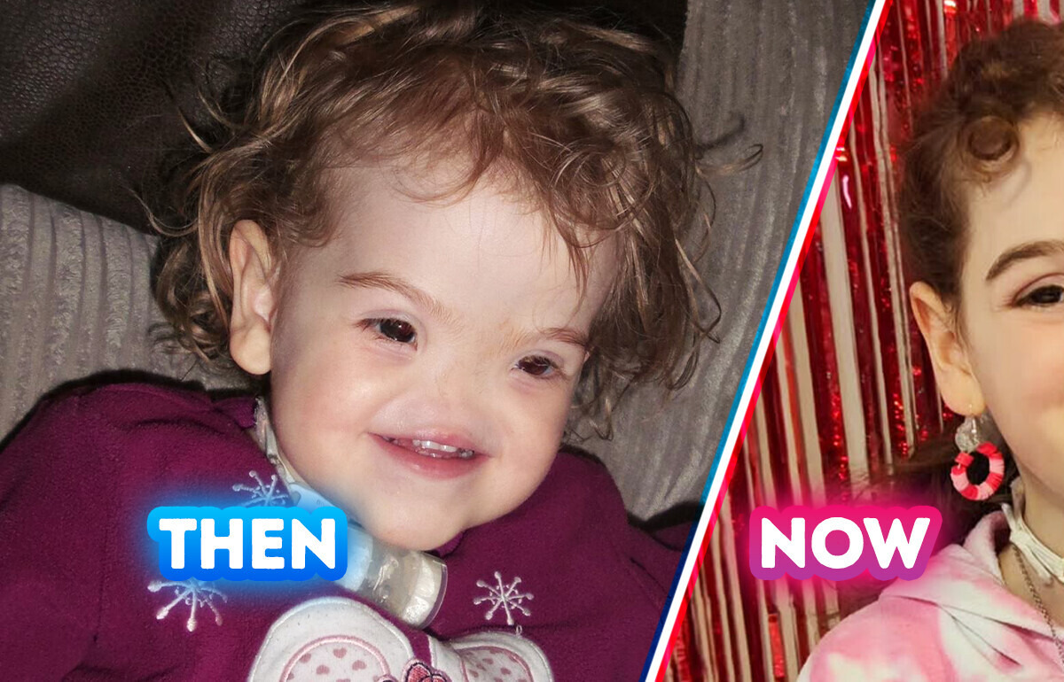 “Voldemort” Baby Grew Up — What She Looks Like Today Will Shock You