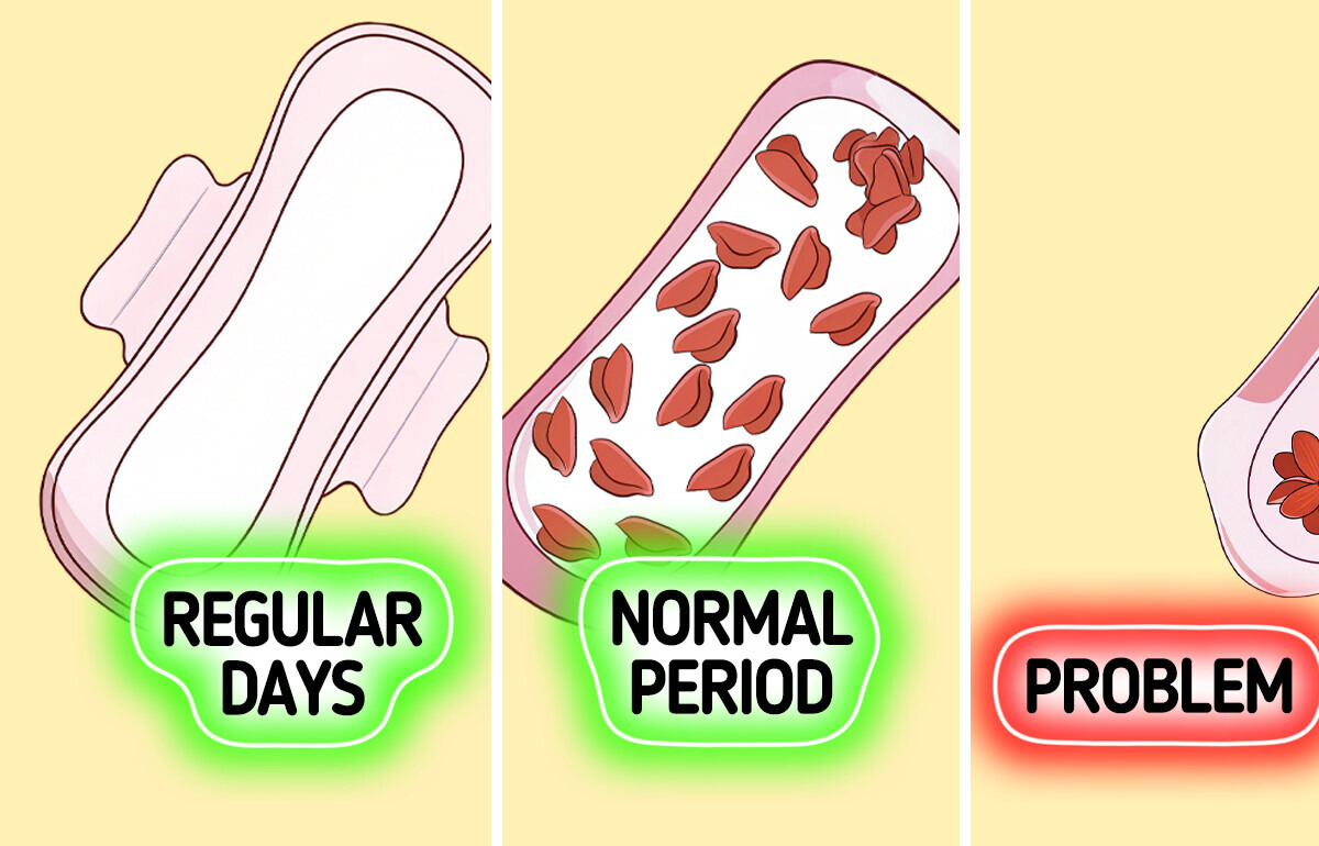 10 Alarming Symptoms That Could Mean You Have Endometriosis