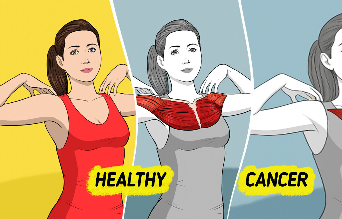 9 Often-Overlooked Signs That Could Help Women Detect Breast Cancer