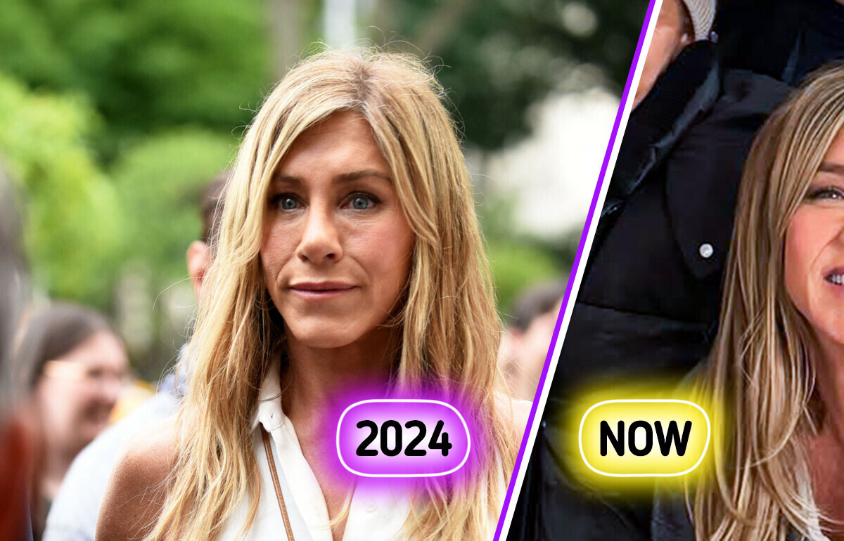 Jennifer Aniston Dissolves Fillers After Online Scrutiny, Sparking Intense Reactions to Her New Look Jennifer Aniston Dissolves Fillers After Online Scrutiny, Sparking Intense Reactions to Her New Look