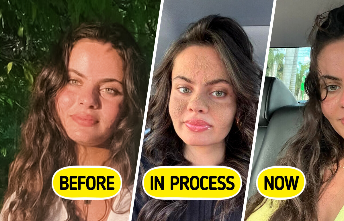 This Woman Stopped Washing Her Face — What Happened Next Sparked a Frenzy This Woman Stopped Washing Her Face — What Happened Next Sparked a Frenzy