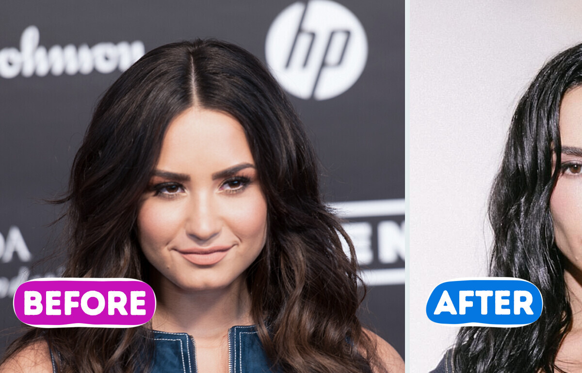 “Can She Actually Move Her Face?” Demi Lovato’s New Look Has Everyone Talking
