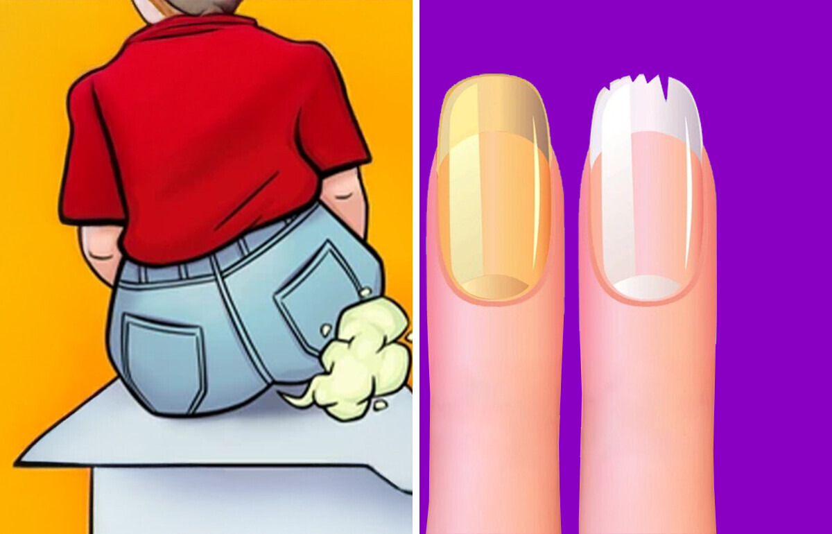 8 Weird Body Signs You’re Actually Lactose Intolerant 8 Weird Body Signs You’re Actually Lactose Intolerant