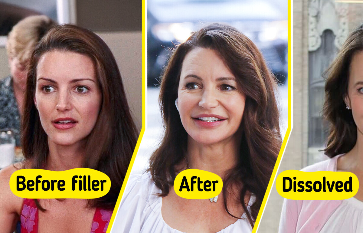8 Celebrities Who Trusted Cosmetic Surgery — and It Went Terribly Wrong