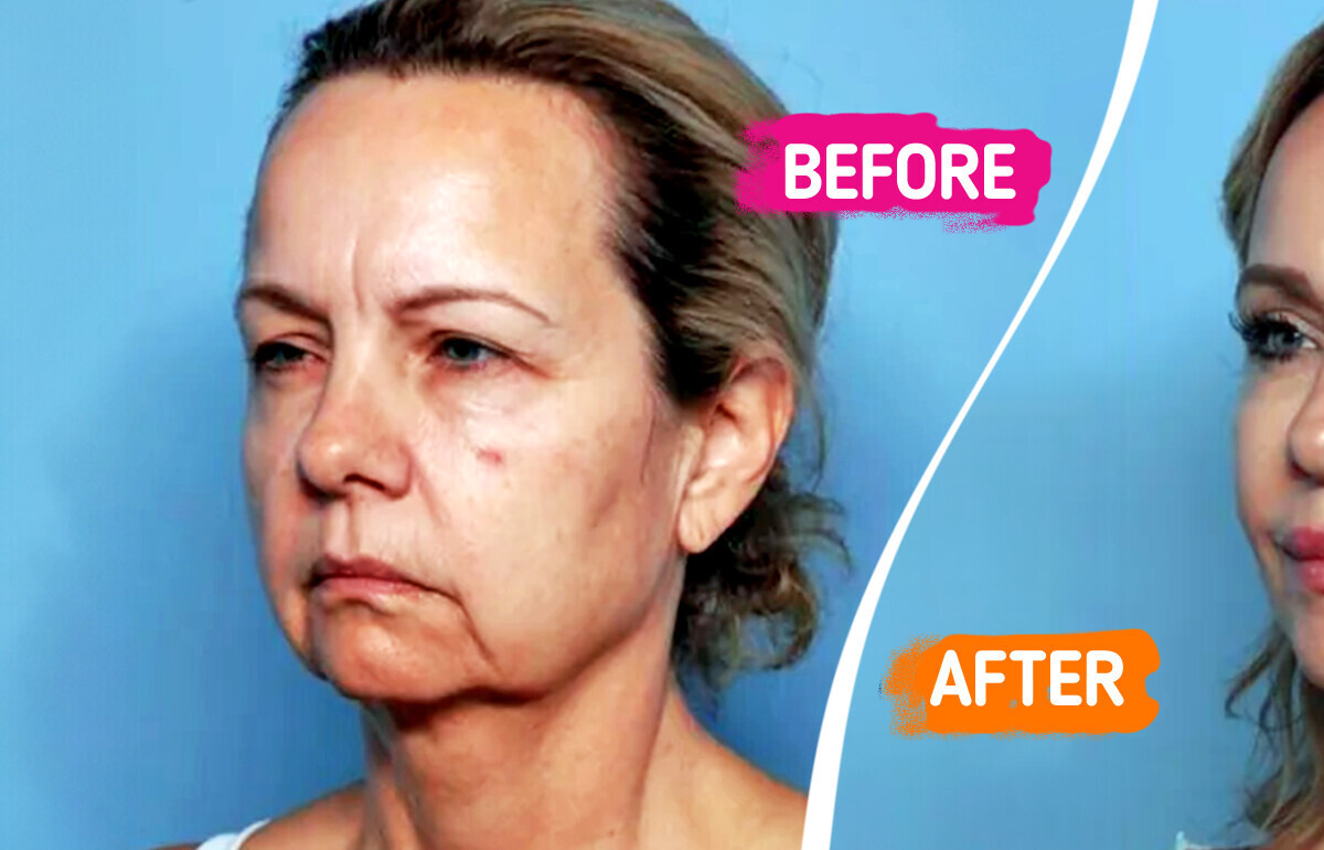 15 People Who Chose Plastic Surgery and Are Totally Obsessed with Their New Looks 15 People Who Chose Plastic Surgery and Are Totally Obsessed with Their New Looks