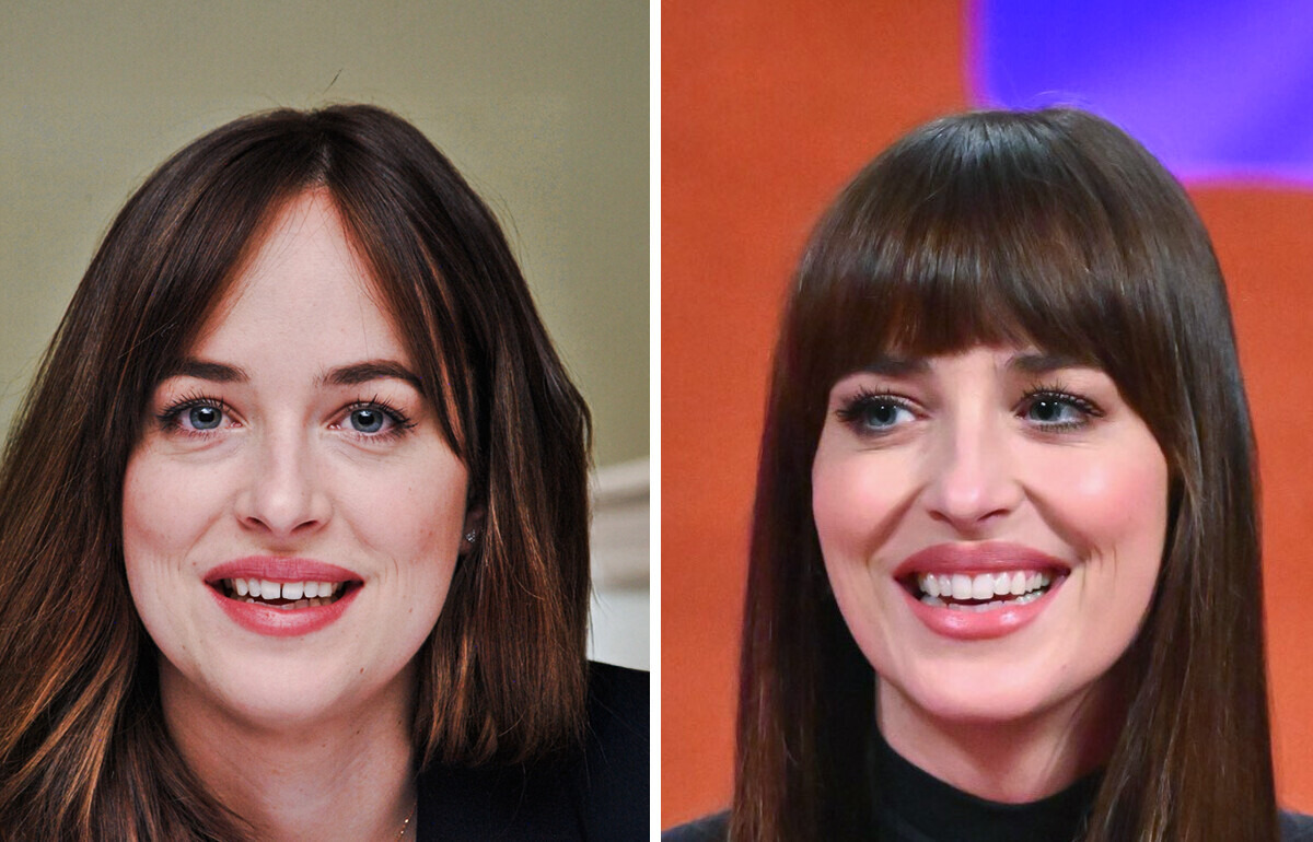 14 Celebrities Who Prove That Teeth Makeovers Can Completely Redefine Your Look 14 Celebrities Who Prove That Teeth Makeovers Can Completely Redefine Your Look