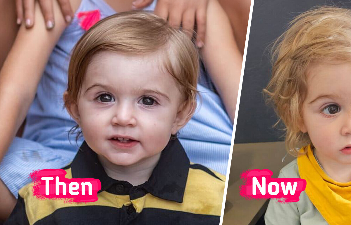 “Don’t Let Anyone Kiss Your Baby!” Mom Urgently Warns People as Doctors Battle to Save Her Baby’s Eye