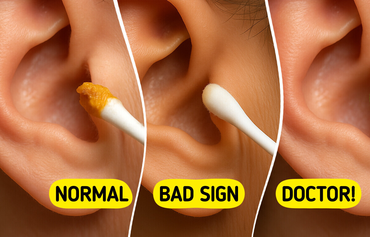 If Your Earwax Looks Like This, See a Doctor Immediately If Your Earwax Looks Like This, See a Doctor Immediately