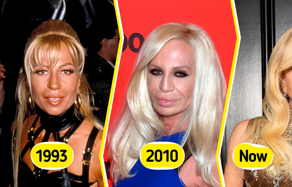 10 Celebrities Who Look Completely Different Than They Used To