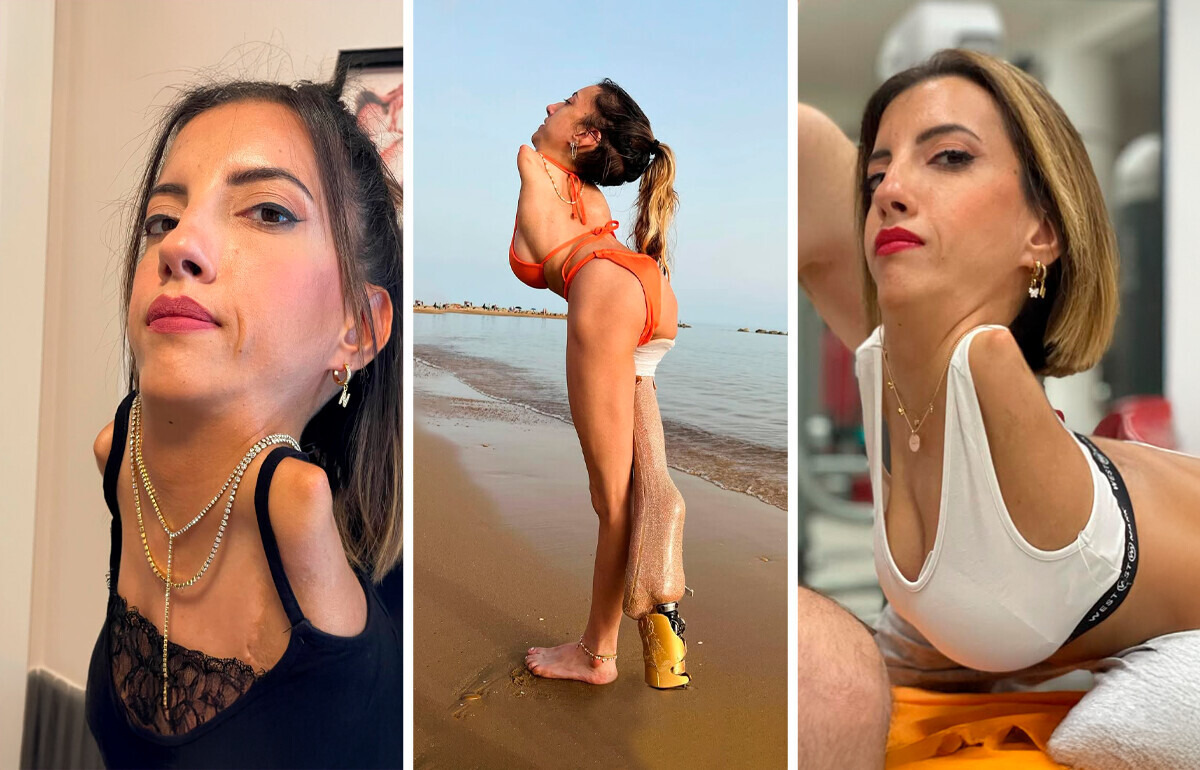 Meet a Woman Who Was Born Without Arms and a Leg. Now She’s Changing the World Meet a Woman Who Was Born Without Arms and a Leg. Now She’s Changing the World