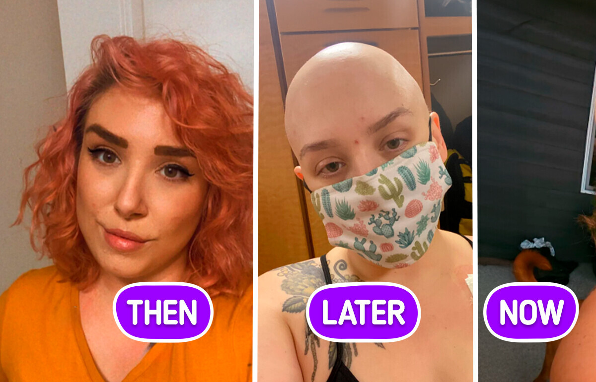 13 Inspiring Pictures of People Who Refused to Give Up on Life