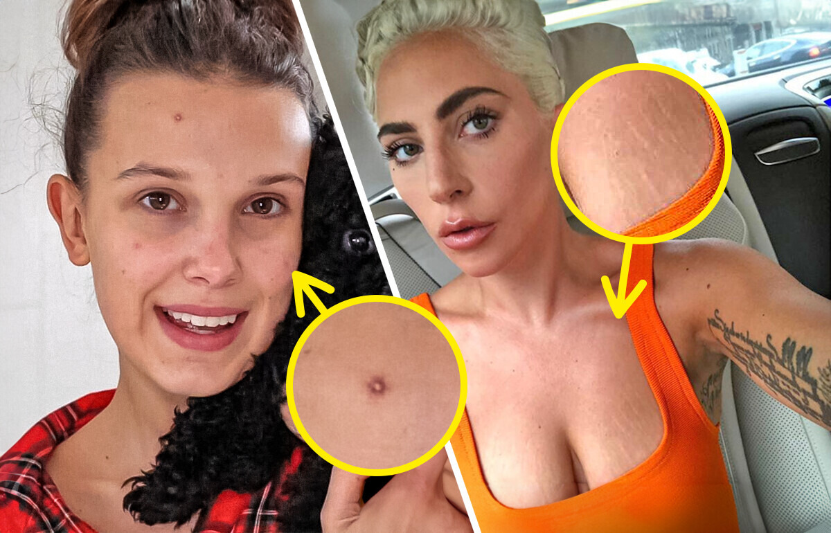 Unfiltered and Unapologetic: 15+ Stars Who Show Their True Selves