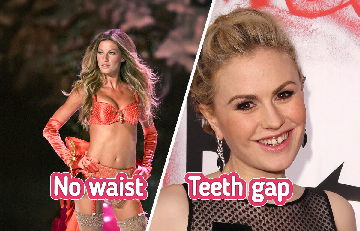 8 Celebrities Who Proudly Embrace Their Unique Features 8 Celebrities Who Proudly Embrace Their Unique Features