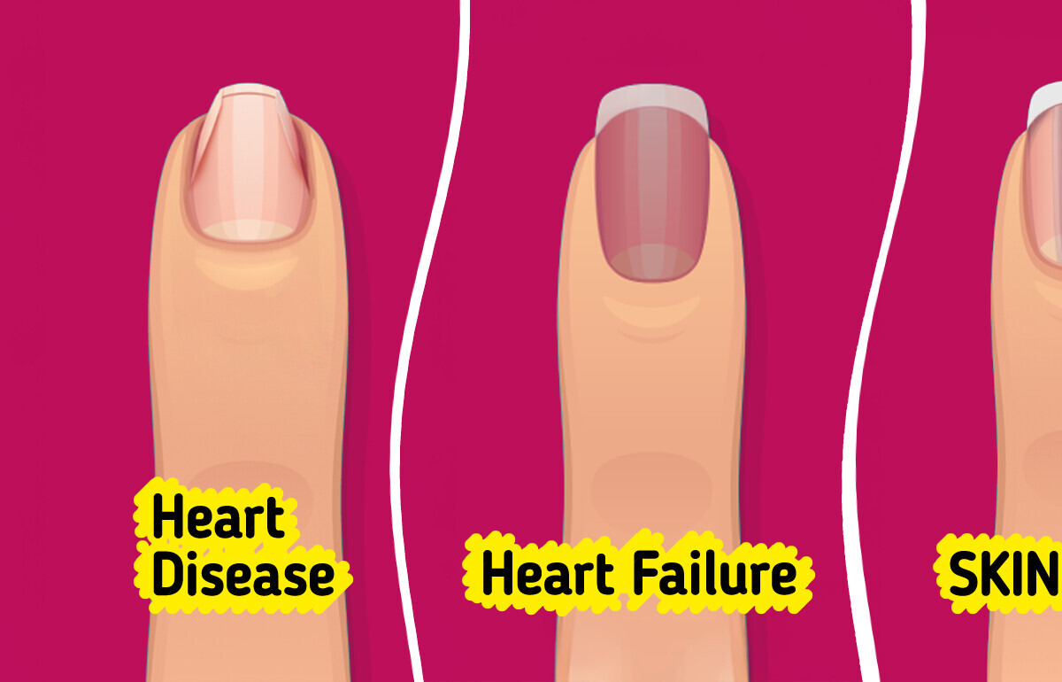 Your Body Might Be Asking for Help and Your Toenails Are the First to Show It