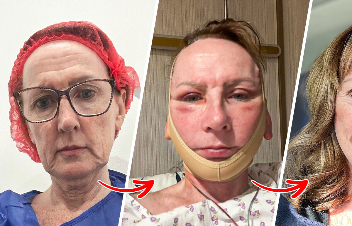 13 Photos Where “Before” and “After” Feel Like Different Universes