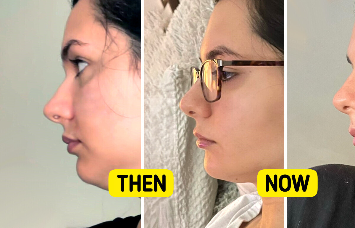 12 Times Beauty Treatments Didn’t Go as Smoothly as Expected