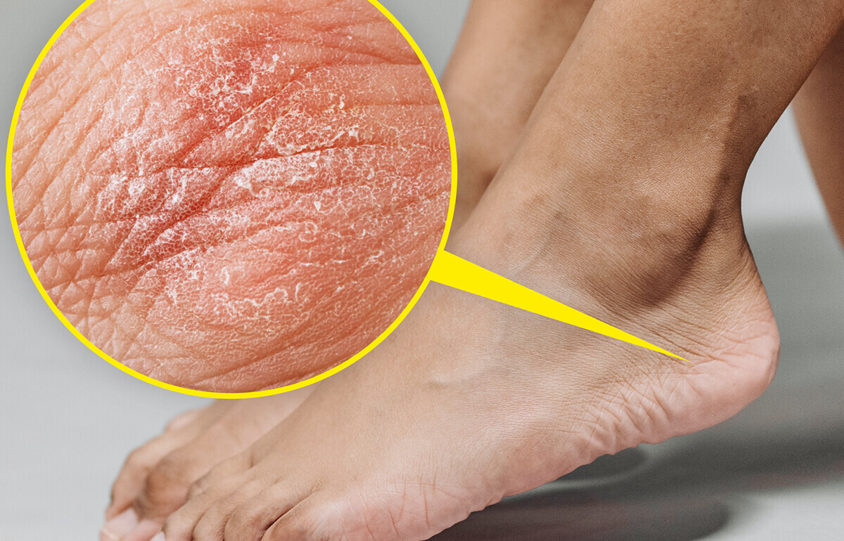 11 Unexpected Signs About Your Health Hidden in Your Feet 11 Unexpected Signs About Your Health Hidden in Your Feet