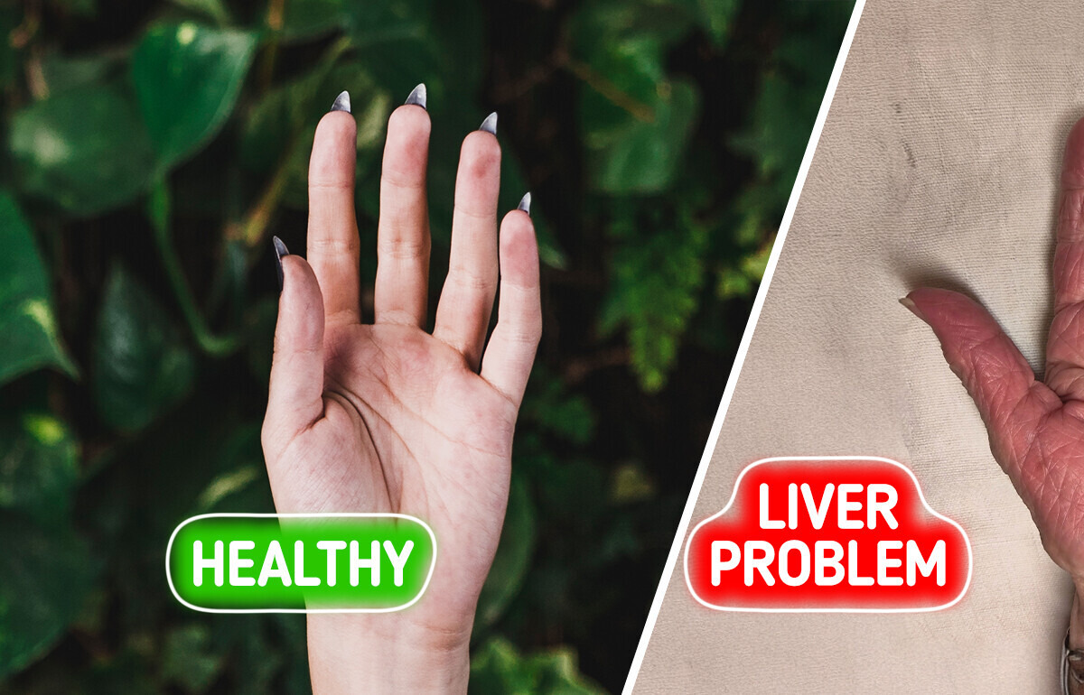 6 Unusual Warning Signs of Liver Issues You Shouldn’t Ignore