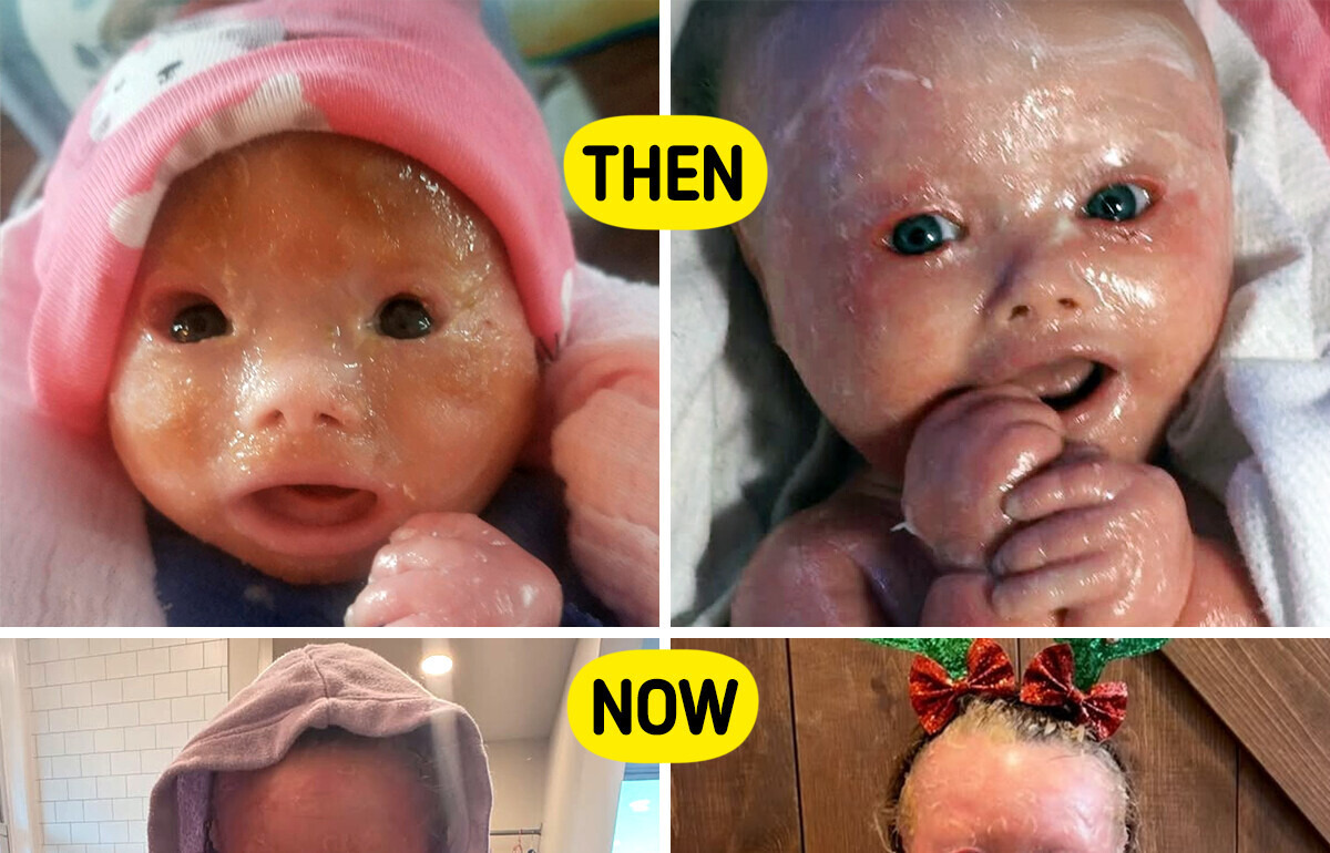 Baby’s Unusual Appearance Shocked the Delivery Room, But See How Gorgeous She Looks Today Baby’s Unusual Appearance Shocked the Delivery Room, But See How Gorgeous She Looks Today