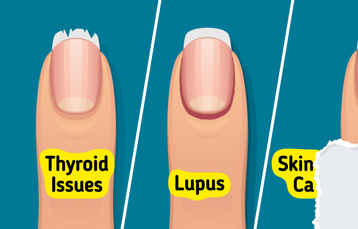 10+ Ways Your Body Could Alert You to Hidden Health Issues 10+ Ways Your Body Could Alert You to Hidden Health Issues