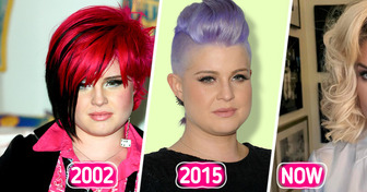 “What Happened to Her Face?” Kelly Osbourne’s Dramatic Transformation Sparks Heated Controversy