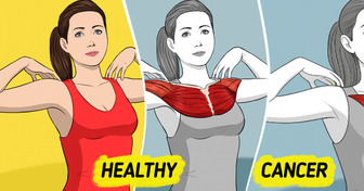Every Woman Deserves to Know These 9 Hidden Breast Cancer Signs
