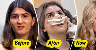 Woman Shares Drastic Plastic Surgery Results After Visiting South Korea, Sparking Heated Buzz
