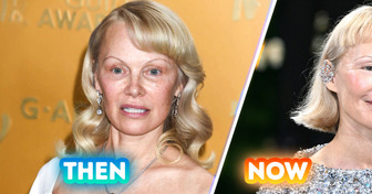 “Not the Bangs!” Pamela Anderson Debuts Bold New Look — and Reactions Are Divided