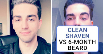 15 Men Who Prove That a Beard Is More Effective Than Plastic Surgery
