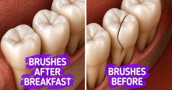 10+ Simple Dental Tips for Healthier Teeth Every Day
