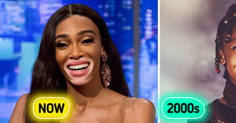 Meet Winnie Harlow, the Vitiligo Supermodel Breaking Beauty Rules Since Childhood