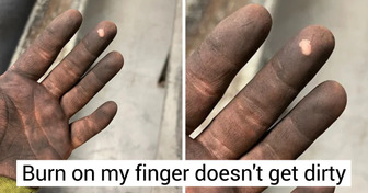 17 People Whose Body Parts Attract a Lot of Attention